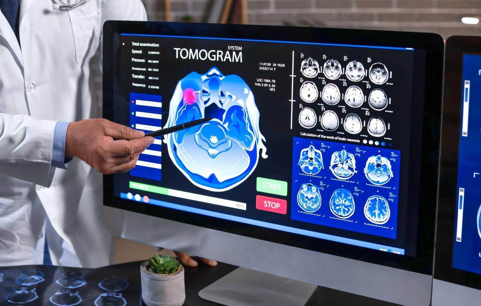 A neurologist demonstrating a traumatic brain injury on a brain scan in Oro Valley, Arizona