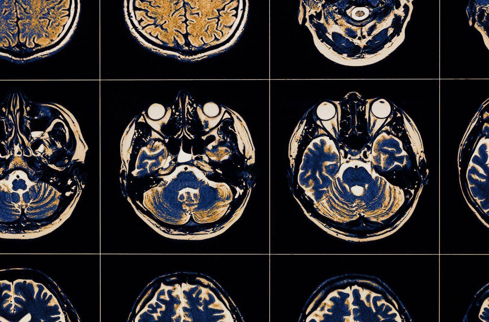 A chart with multiple brain scans of a car accident victim with nerve damage in Corpus Christi, Texas