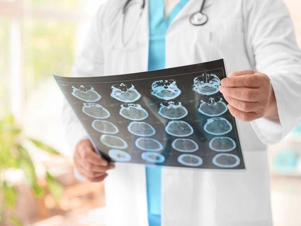 when-to-see-a-neurologist-in-Atlanta[1]